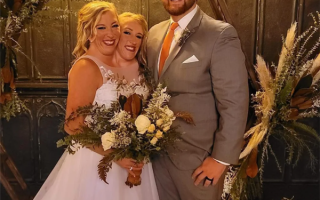 共享身体！美国连体双胞胎姐妹其中一人已婚 网友直呼神奇 ！