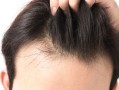促进头发生长的方法（促进头发快速生长的技巧） !