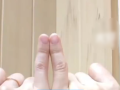 女子长期用小拇指托手机后果：日均刷机8小时手指变形 !