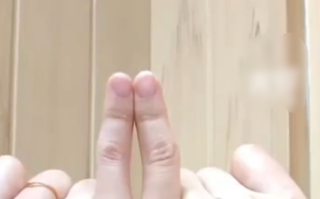 女子长期用小拇指托手机后果：日均刷机8小时手指变形 !