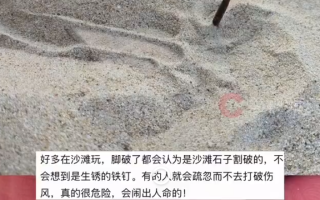 女子在沙滩玩20分钟捡了小半兜钉子！当事人：不知道是不是人为的，已报警 ！