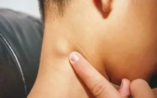 5岁男孩脖子长小疙瘩确诊癌症晚期 医生提醒 !