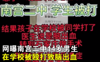 教育局回应男孩校内被打致脑出血：正在调查，学校已垫付3万治疗费 ！