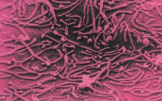 支原体肺炎不是新冠的变异！张文宏：差异远超人类和苍蝇 !