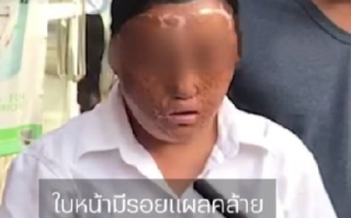 泰媒:曼谷现多名中国籍毁容乞讨者，警方怀疑此事极有可能涉及人口贩卖 ！