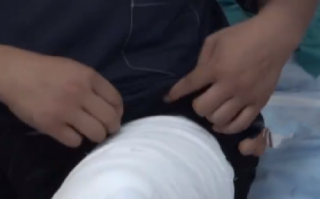 考研在即大四男生割皮救母 ！直言：“只要能救俺妈，我植多少皮都中” ！