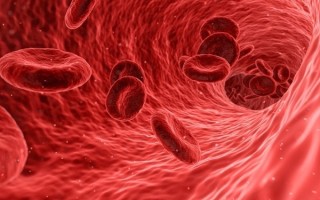 女子超量服20天布洛芬引发脑梗死：突然昏迷 ！