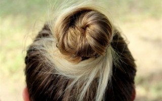 12岁女孩胃里取出20厘米“石头”：异食癖 长期吃头发导致 ！