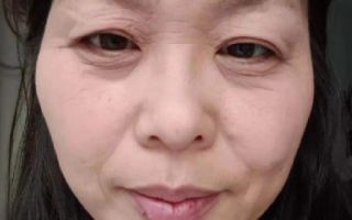断崖式衰老女子本以为能漂亮过余生：慢慢衰老，没想到来这么当头一棒 ！