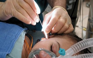 上海人工耳蜗纳入医保：可帮患者减轻7成费用 ！