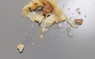 孩子在云吞中吃出牙齿?家长投诉，提出3项诉求！