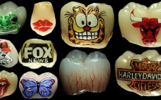 “发财”“上岸”刻牙上 牙齿上刻字成新玄学！专家：不建议 !