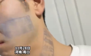 男子玩游戏被盖猪肉印章去除不了 ！当事人：出门穿高领毛衣和戴口罩 ！