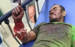 菲律宾男子遭巨蟒缠身 狠咬蛇脖自救：附近村民们“把它当饭吃” ！