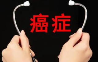 癌症发病年轻化?国家癌症中心回应：不能一概而论，不同癌症发病的年龄分布差异是比较大的 ！