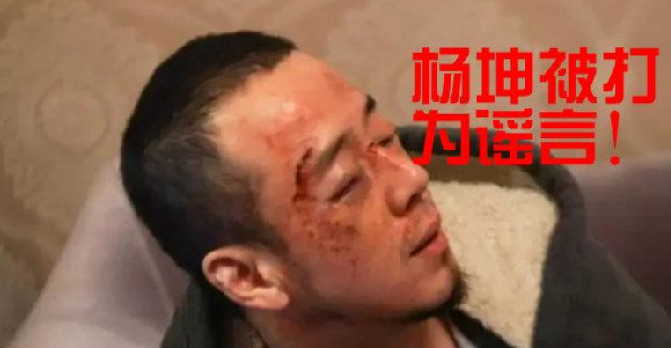 歌手杨坤在长沙被打?假的，长沙警方并未接到该起报警 ！-第1张图片