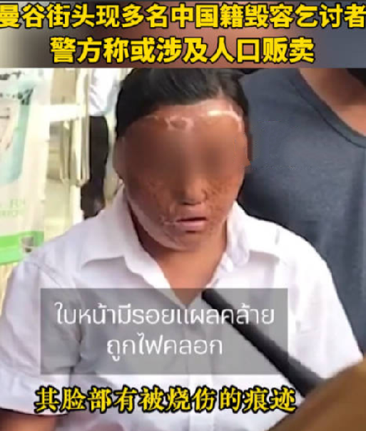 泰媒:曼谷现多名中国籍毁容乞讨者，警方怀疑此事极有可能涉及人口贩卖 ！-第1张图片