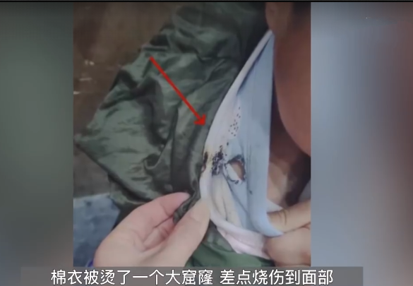 天降烟头6岁男童棉衣被烫穿：全楼DNA采集完毕高空丢烟头者才现身 ！-第1张图片