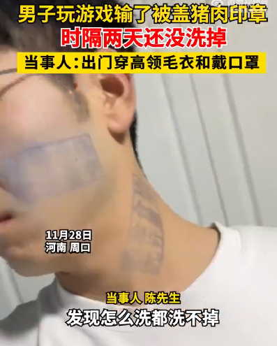 男子玩游戏被盖猪肉印章去除不了 ！当事人：出门穿高领毛衣和戴口罩 ！-第1张图片