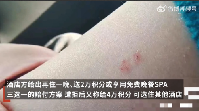 旅客称花2500元住酒店被蛇咬！酒店：涉事房间已封锁，补偿暂未达成共识 ！-第1张图片